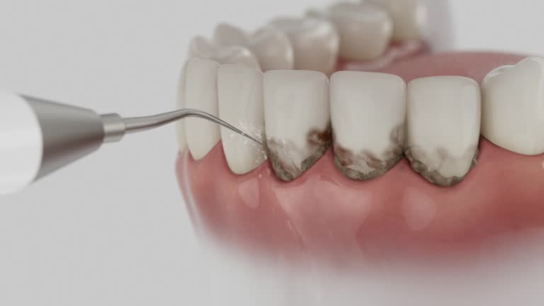 Trusted Tooth Extraction service in Vienna, IL - Dentist Open Now